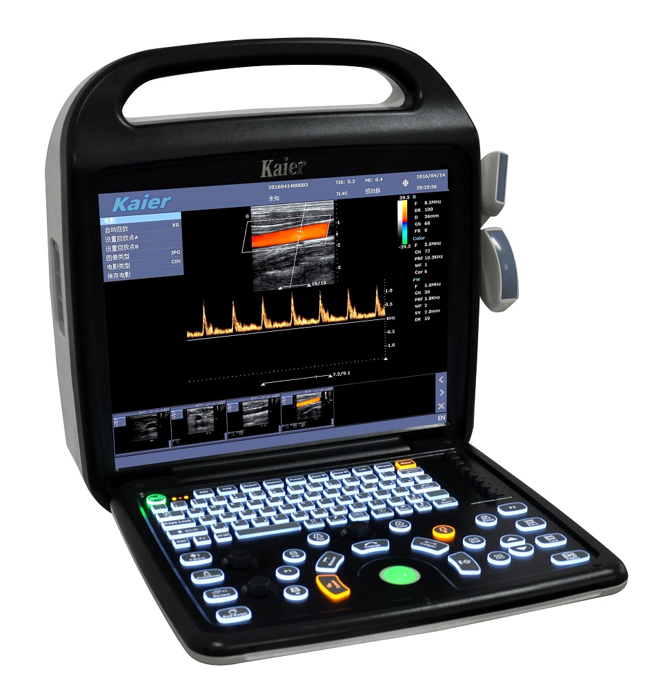 Color Doppler ultralydsbilledsystem